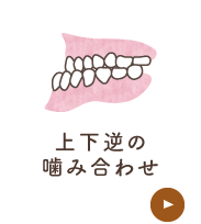 上下逆の噛み合わせ
