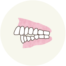 上の前歯が大きく前に出ている歯並びのイラスト